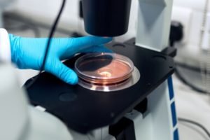 diagnostic lab case gallery 4 300x200.jpg
